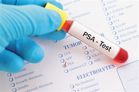 does alcohol affect psa test